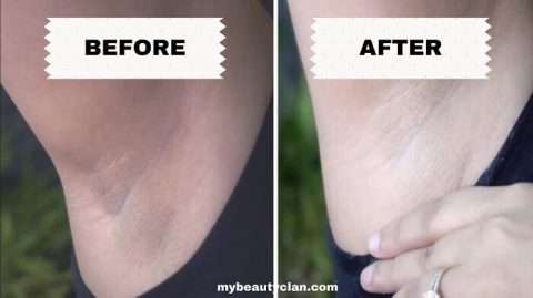 🥇 The Ordinary Glycolic Acid For Your Armpits | My Beauty Clan